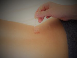 Heilpraktikerin, Heilpraktiker, Manuelle Therapie, Rückenschmerzen, Tapen, Ohr, Akupunktur, Ohrakupunktur, Reiki, Schröpfen, Gua sha, Energiearbeit, Burn Out, Ernährung, Atmen