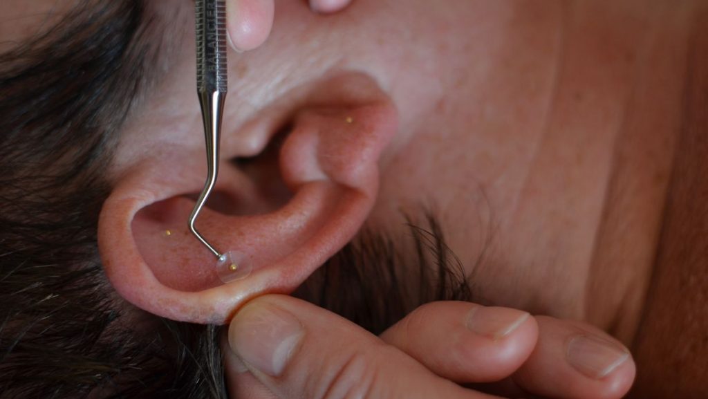 Heilpraktikerin, Heilpraktiker, Manuelle Therapie, Rückenschmerzen, Ohr, Akupunktur, Ohrakupunktur, Reiki, Schröpfen, Gua sha, Energiearbeit, Burn Out, Ernährung, Atmen